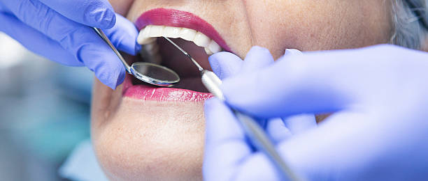 Best Emergency Dental Services for Seniors in Scottsville, NY